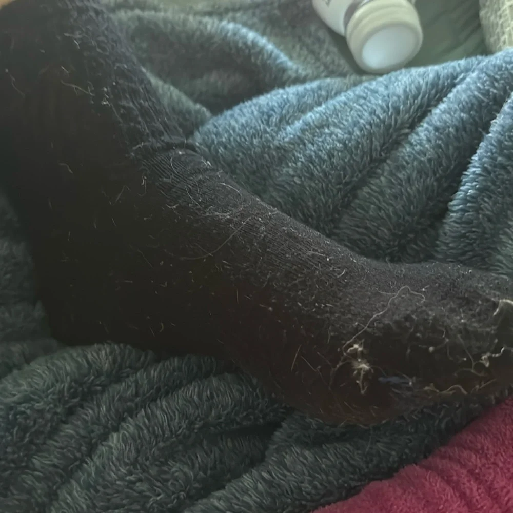 Taco munchers unwashed stinky socks (comes with the feet)